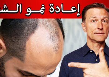 العلاج الطبيعي للصلع: كيف يعزز الروزماري كثافة الشعر؟