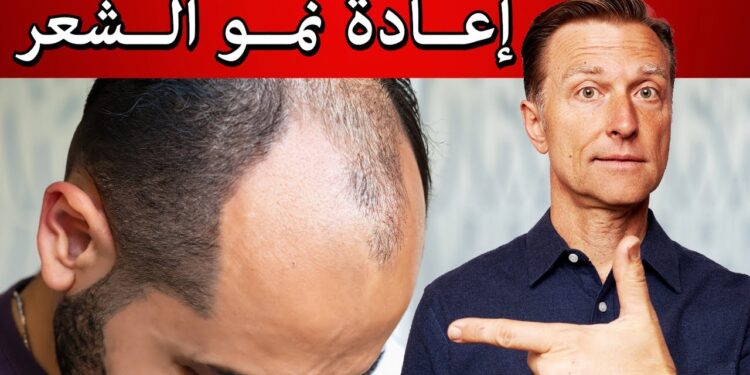 العلاج الطبيعي للصلع: كيف يعزز الروزماري كثافة الشعر؟ 1 العلاج الطبيعي للصلع: كيف يعزز الروزماري كثافة الشعر؟