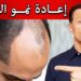 العلاج الطبيعي للصلع: كيف يعزز الروزماري كثافة الشعر؟ 2 العلاج الطبيعي للصلع: كيف يعزز الروزماري كثافة الشعر؟