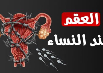 العقم عند النساء: تحديد العيب الوراثي الرئيسي المؤثر