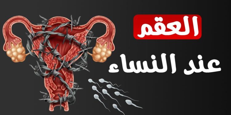 العقم عند النساء: تحديد العيب الوراثي الرئيسي المؤثر 1 العقم عند النساء: تحديد العيب الوراثي الرئيسي المؤثر