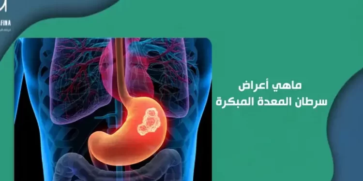 هل تتحول حرقة المعدة إلى خطر على صحتك؟ 1 هل تتحول حرقة المعدة إلى خطر على صحتك؟