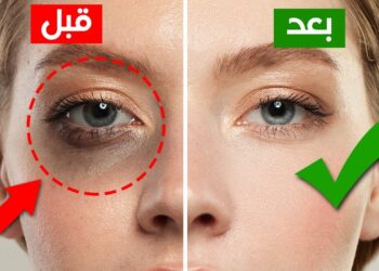 التخلص من الهالات السوداء بسهولة مع هذا الماسك الفعال