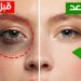 التخلص من الهالات السوداء بسهولة مع هذا الماسك الفعال 2 التخلص من الهالات السوداء بسهولة مع هذا الماسك الفعال