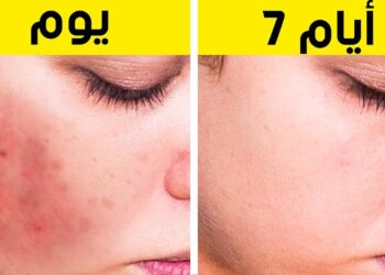 وصفات طبيعية لتبييض الجسم والتخلص من البقع الداكنة في المنزل