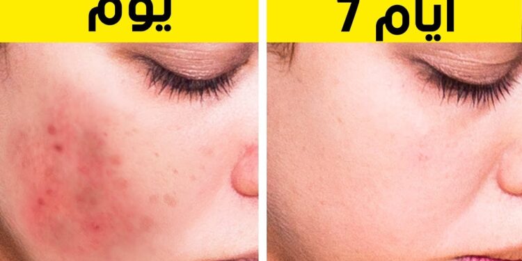 وصفات طبيعية لتبييض الجسم والتخلص من البقع الداكنة في المنزل 1 وصفات طبيعية لتبييض الجسم والتخلص من البقع الداكنة في المنزل