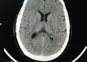 أهمية الأشعة في تحسين دقة التشخيص وتخطيط العلاجات الطبية