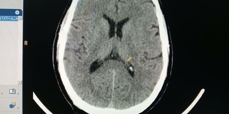 أهمية الأشعة في تحسين دقة التشخيص وتخطيط العلاجات الطبية 1 أهمية الأشعة في تحسين دقة التشخيص وتخطيط العلاجات الطبية