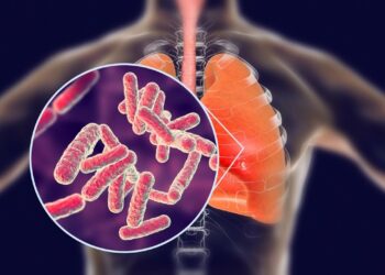 مرض السل ينتشر بشكل غير مسبوق في ولاية أمريكية