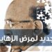 التطورات العلمية الكبرى في 2024 اكتشافات هامة في علاج ألزهايمر 2 التطورات العلمية الكبرى في 2024 اكتشافات هامة في علاج ألزهايمر