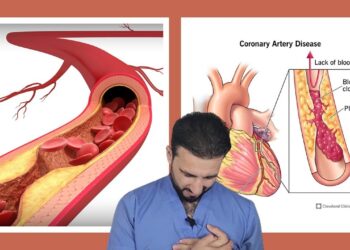 أعراض تصلب الشرايين غير التقليدية وتأثيرها على الصحة