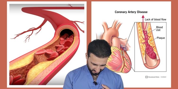 أعراض تصلب الشرايين غير التقليدية وتأثيرها على الصحة 1 أعراض تصلب الشرايين غير التقليدية وتأثيرها على الصحة