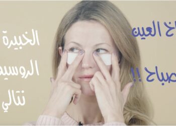 الانتفاخات تحت العين علامات لمشاكل صحية خفية