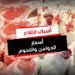 أسعار اللحوم والدواجن ترتفع رسميًا اليوم 5 فبراير 2025 في مصر 2 أسعار اللحوم والدواجن ترتفع رسميًا اليوم 5 فبراير 2025 في مصر