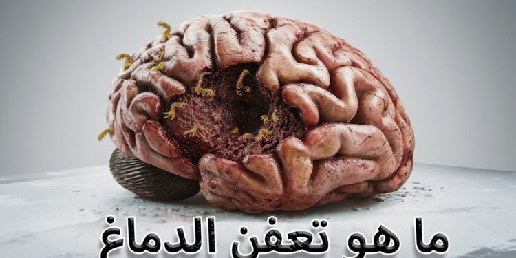 الدماغ والتدخين كيف يقلص حجم الدماغ ويزيد من خطر الخرف والزهايمر 1 الدماغ والتدخين كيف يقلص حجم الدماغ ويزيد من خطر الخرف والزهايمر