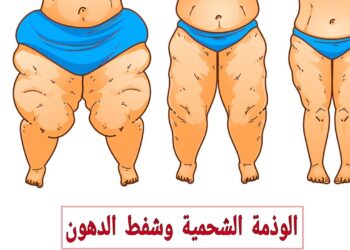 الوذمة خطر يهدد صحتك.. تحذيرات من خبيرة مختصة