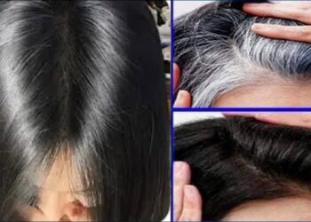 الشعر الأبيض في الشباب 6 أسباب خفية تؤدي إلى ظهور الشيب مبكرًا