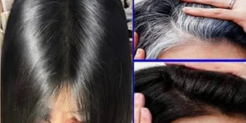الشعر الأبيض في الشباب 6 أسباب خفية تؤدي إلى ظهور الشيب مبكرًا