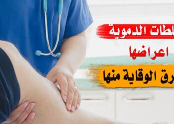 نقلة نوعية في الطب الحديث لعلاج الجلطات الدموية بدون مضاعفات