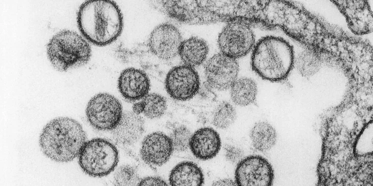 منظمة الصحة تحذر من بكتيريا قاتلة تنتقل بين البشر 1 منظمة الصحة تحذر من بكتيريا قاتلة تنتقل بين البشر