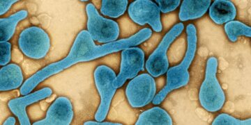 فيروس ماربورغ لن ينتشر في مصر، وتطمينات رسمية للمواطنين 2 فيروس ماربورغ لن ينتشر في مصر، وتطمينات رسمية للمواطنين