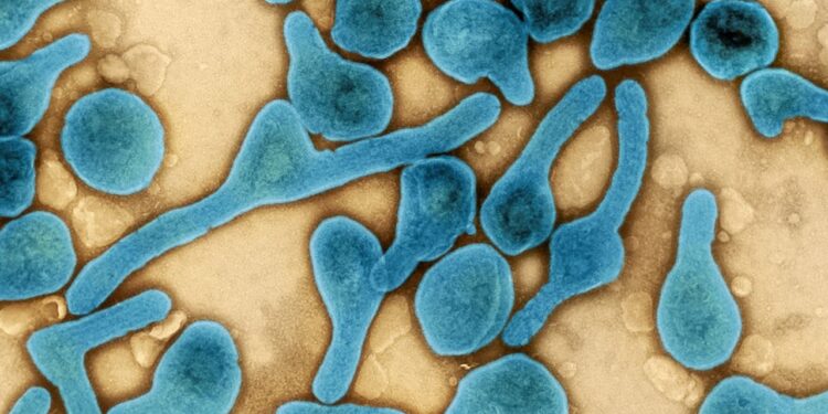 فيروس ماربورغ لن ينتشر في مصر، وتطمينات رسمية للمواطنين 1 فيروس ماربورغ لن ينتشر في مصر، وتطمينات رسمية للمواطنين