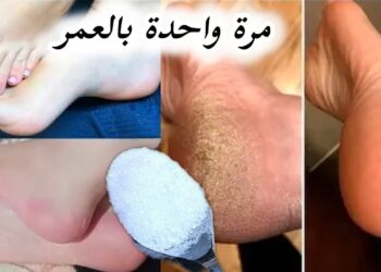 وصفة منزلية مجربة للقضاء على تشققات الكعبين وسواد القدم خلال يوم